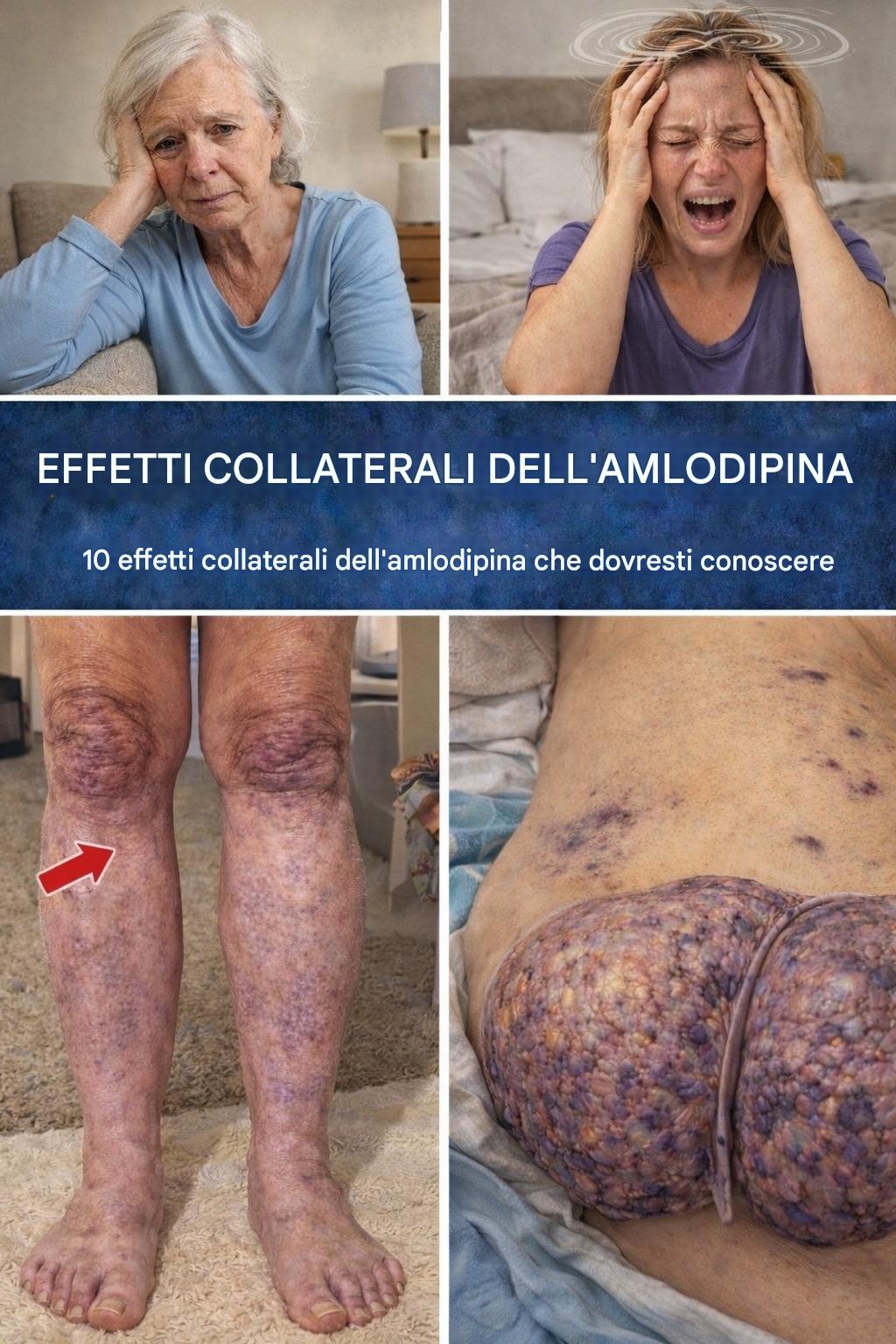 Scopri i 12 principali effetti collaterali dell’amlodipina e semplici consigli quotidiani per sentirti più a tuo agio. - BuzzDay