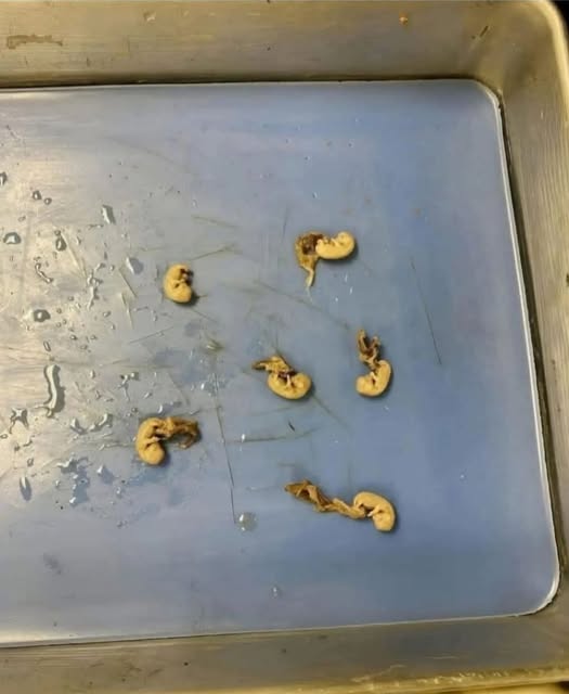 Tod in der Tüte: Warum Ihr Lieblingssnack, der eigentlich gesund sein sollte, Ihre ganze Familie heimlich vergiftet - BuzzDay