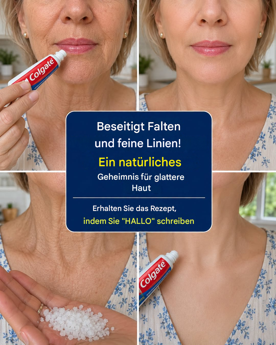 Warum dieser einfache Zahnpasta-Hautpflegetrick so viel Aufmerksamkeit erregt (und wie man ihn sicher anwendet) .H - BuzzDay
